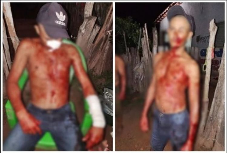 Com Informações: Meio Norte