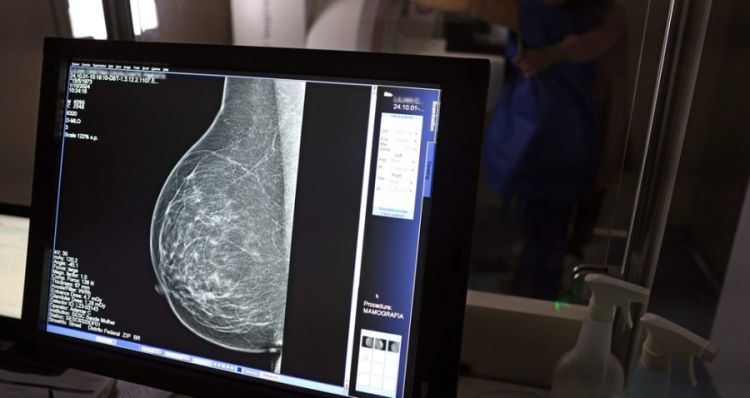 IA pode identificar calcificação de artérias por meio da mamografia