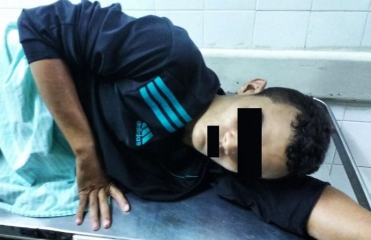 Adolescente foi alvejado por um tiro nas nádegas, ao assaltar uma idosa e levar um aparelho celular. Fonte e fotos: portalcostanorte