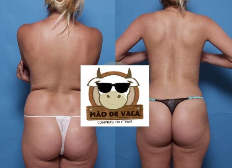 Foto ilustrativa da internet