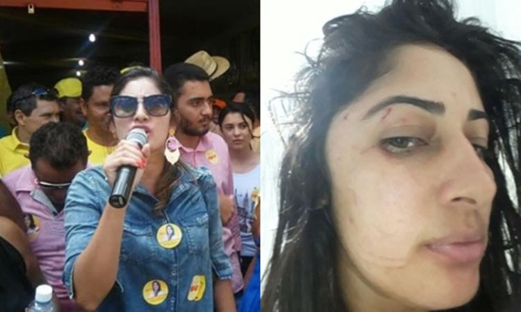 Suplente de vereadora disse que foi agredida e sequestrada por cinco mulheres de Tauá-CE. Com informações do PiauiEmFoco