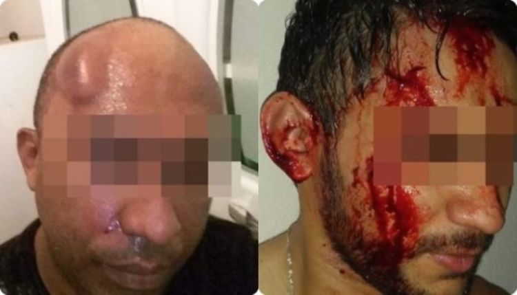 Fonte: G1. Fotos: Divulgação