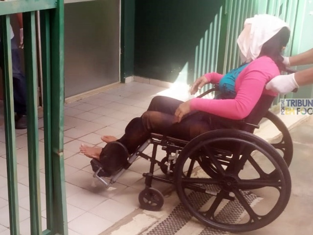 Acidente deixa casal ferido após colisão entre moto e carro na zona rural de Buriti dos Montes (PI)