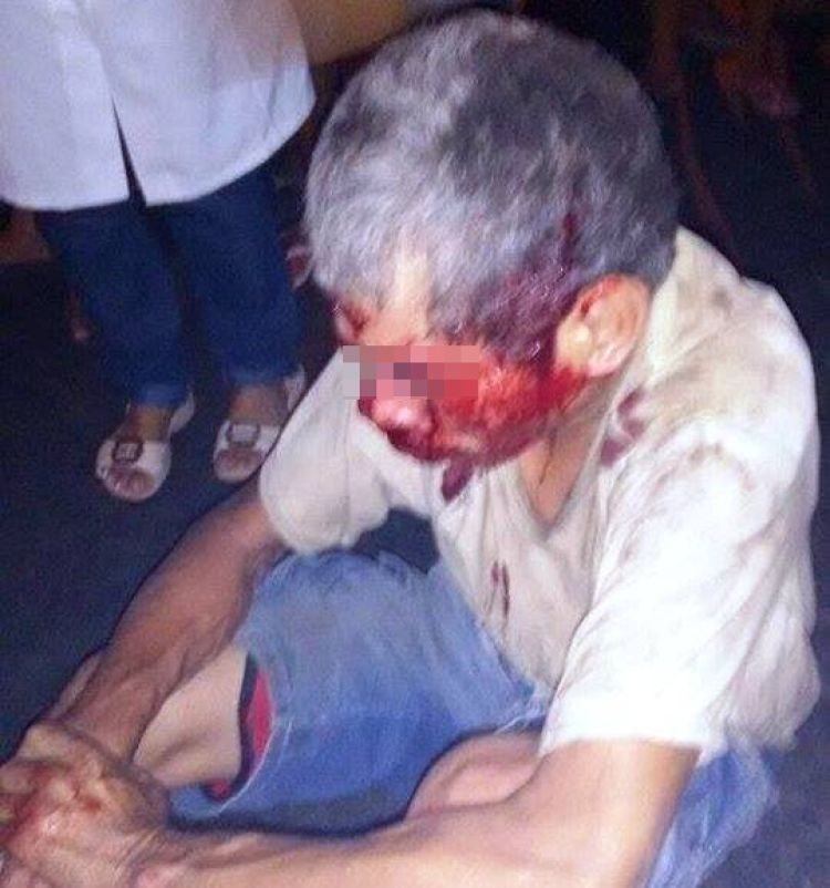 A vítima 2º caso caiu de sua moto depois de colidir com um andarilho.  A vítima 2º caso caiu de sua moto depois de colidir com um andarilho.