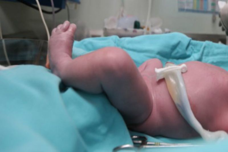 Bebe De 8 Meses De Gestacao Tem Cabeca Arrancada Durante Parto No Estado Do Para Bebe De 8 Meses De Gestacao Tem Cabeca Arrancada Durante Parto No Estado Do Para